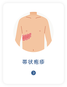 帯状疱疹